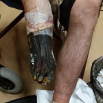 DARUJTE NOHY V TEPLE lidem bez domova